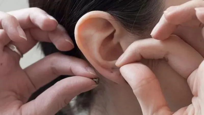 Nhiễm trùng lỗ xỏ là nguyên nhân phổ biến gây mùi hôi khi đeo bông tai