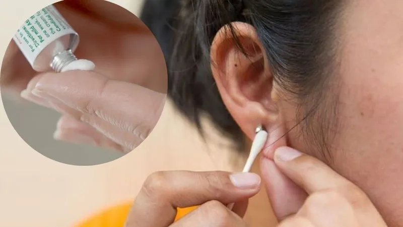 Vệ sinh và cấp ẩm cho tai trước khi đeo bông giúp phòng ngừa kích ứng